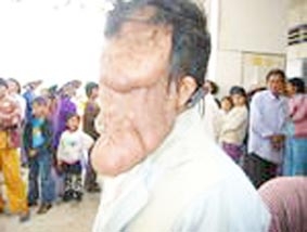 Người đàn ông bệnh tật khốn khó!
