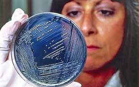 Khuẩn Salmonella  vũ khí mới chống ung thư