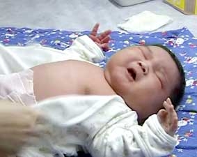Trẻ sơ sinh nặng hơn 7 kg