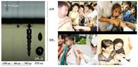 Công nghệ tiêm thuốc bằng laser không gây đau đớn