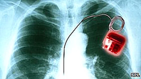 Triển vọng phát triển “máy trợ tim sinh học”