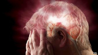 Giải mã cơ chế tự bảo vệ tế bào 
của não sau cơn đột quỵ