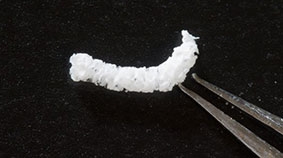 Tơ chứa adenosine hứa hẹn chữa bệnh động kinh