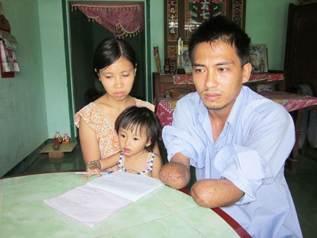 Thanh Nhiên mong được hỗ trợ lắp tay giả