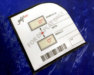 Giấy thử giúp xác định nhóm máu trong vòng một phút