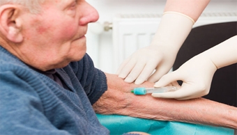 Chip sinh học phát hiện dấu hiệu sớm của bệnh Alzheimer