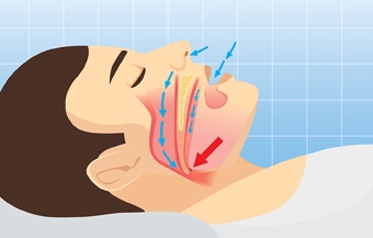 6 bệnh nguy hiểm ít biểu hiện nhưng âm thầm hủy hoại sức khỏe