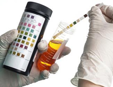 Xét nghiệm nước tiểu xác định chế độ ăn