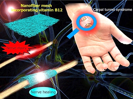 Lưới nano hỗ trợ điều trị tổn thương dây thần kinh