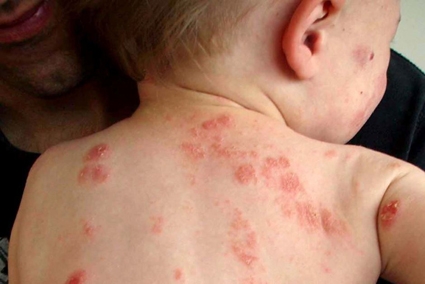 Nguy cơ sức khỏe của bé khi mẹ bị stress trước và trong thai kỳ
