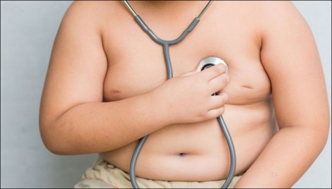 Béo phì ở tuổi vị thành niên, lớn lên dễ bị ung thư ruột