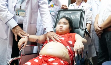 Can thiệp thành công cho bệnh nhi mắc hội chứng Cushing hiếm gặp