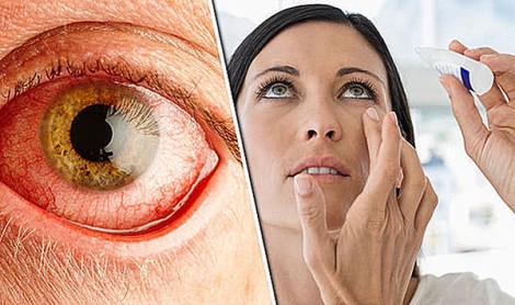 10 bệnh lý ảnh hưởng đến đôi mắt