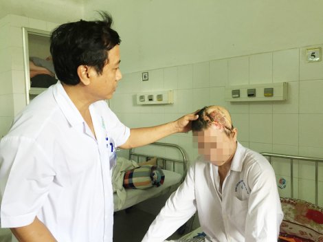 Tai nạn điện - Một phút bất cẩn, thương tật cả đời