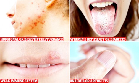 Những dấu hiệu cảnh báo bệnh tật từ cơ thể