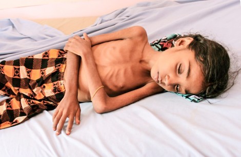 Thảm kịch cuộc chiến của Saudi Arabia tại Yemen