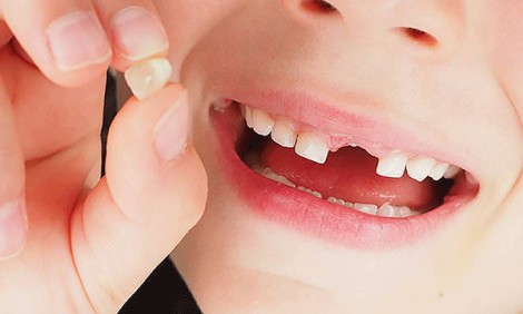 Chẩn đoán sức khỏe tâm thần qua răng