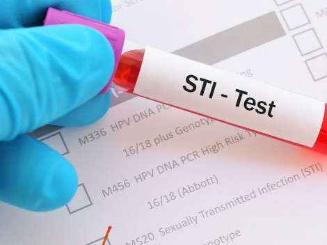 Một triệu ca STI

được chẩn đoán mỗi ngày