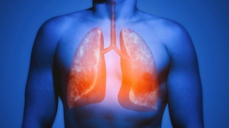 Phổi chữa lành tổn thương do hút thuốc một cách kỳ diệu