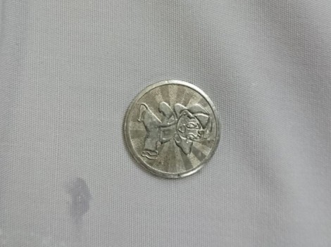 Phải gây mê để lấy đồng xu trong thực quản cậu bé 3 tuổi