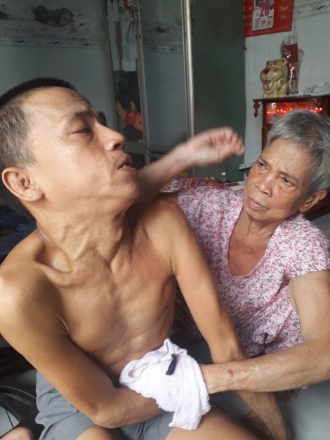 Mong đủ sức khỏe để chăm sóc con trai bại liệt