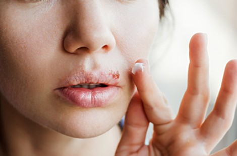 Những liệu pháp tại gia “lợi bất cập hại”