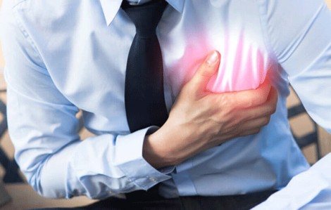 Chụp X-quang có thể giúp dự đoán sớm nhồi máu cơ tim