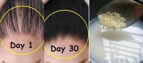 Giải pháp tự nhiên giúp ngăn rụng tóc và kích thích mọc tóc