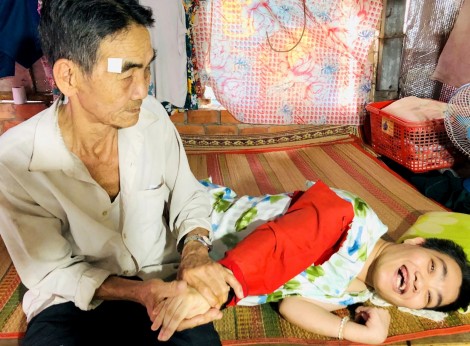 Cha già nuôi con gái tật nguyền