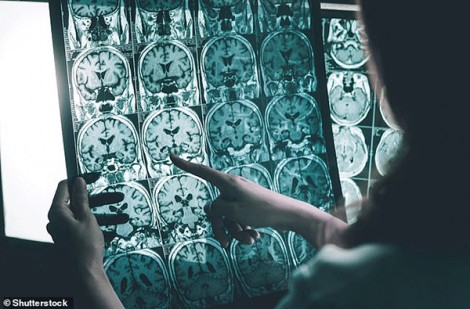 Cải thiện chất lượng không khí giúp giảm nguy cơ sa sút trí tuệ