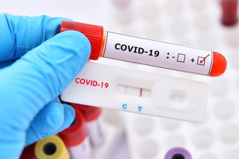 Bộ Y tế: Các DN khẩn trương báo cáo giá bán test xét nghiệm COVID-19