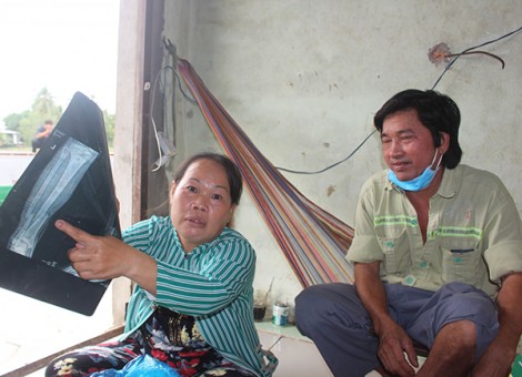 Xót thương anh phụ hồ không có điều kiện chữa trị chân