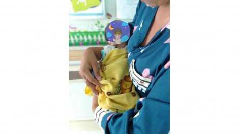 Cứu sống em bé 5 ngày tuổi thủng dạ dày bẩm sinh