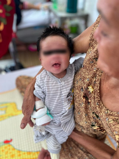 Chữa trị thành công em bé 16 ngày tuổi mắc uốn ván