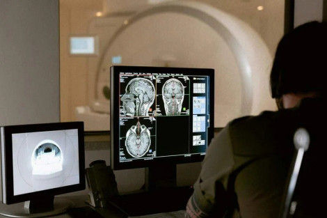 Kỹ thuật mới giúp chẩn đoán sớm bệnh Parkinson