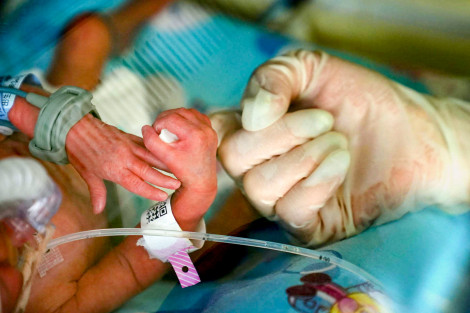 Sinh non là “tình trạng khẩn cấp thầm lặng” của thế giới