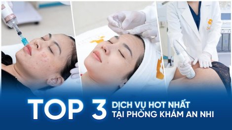 Top 3 dịch vụ hiệu quả và hot nhất tại An Nhi không thể bỏ qua