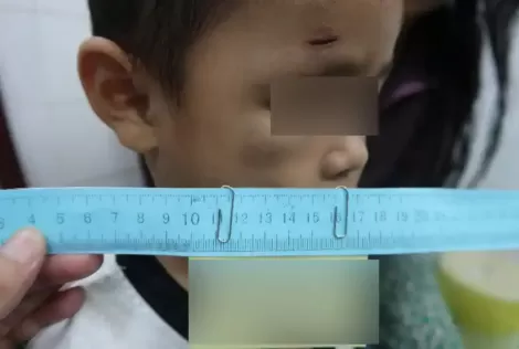 Bảo vệ trẻ em trước vấn nạn bạo hành