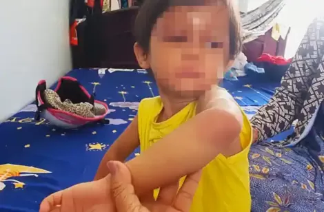 Cà Mau: Bảo vệ khẩn cấp bé gái bị đánh sưng phù mặt