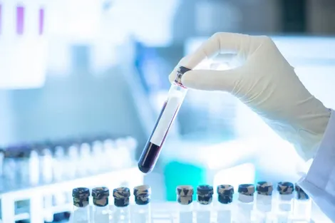 Xét nghiệm máu phát hiện sớm đa ung thư của công ty Grail trên lộ trình xin được FDA cấp phép