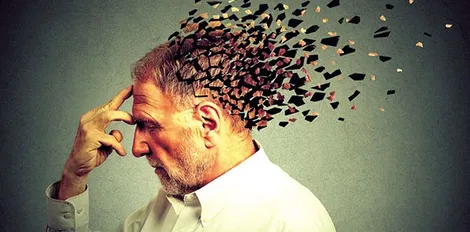 Phát hiện 5 dạng khác nhau của bệnh Alzheimer
