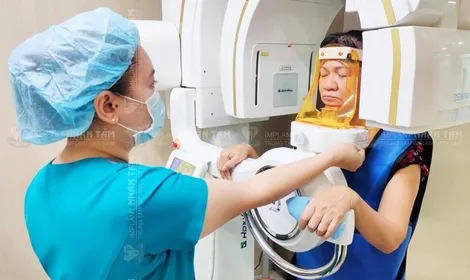 Giá trồng răng Implant là bao nhiêu? Tại sao lại cao hơn phương pháp khác?