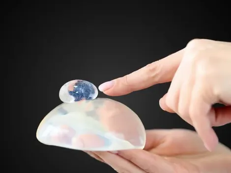 Bác sĩ CKI Châu Thanh Phong chỉ ra 3 lý do tại sao phụ nữ nên thực hiện siêu âm tuyến vú định kỳ sau nâng ngực