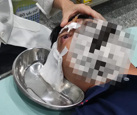 Cấp cứu kịp thời đôi mắt bị bỏng axit do tai nạn lao động