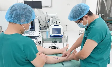 Điều trị bệnh suy giãn tĩnh mạch chi dưới