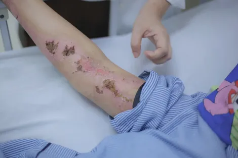 Chủ động phòng tránh sét đánh trong mùa mưa giông